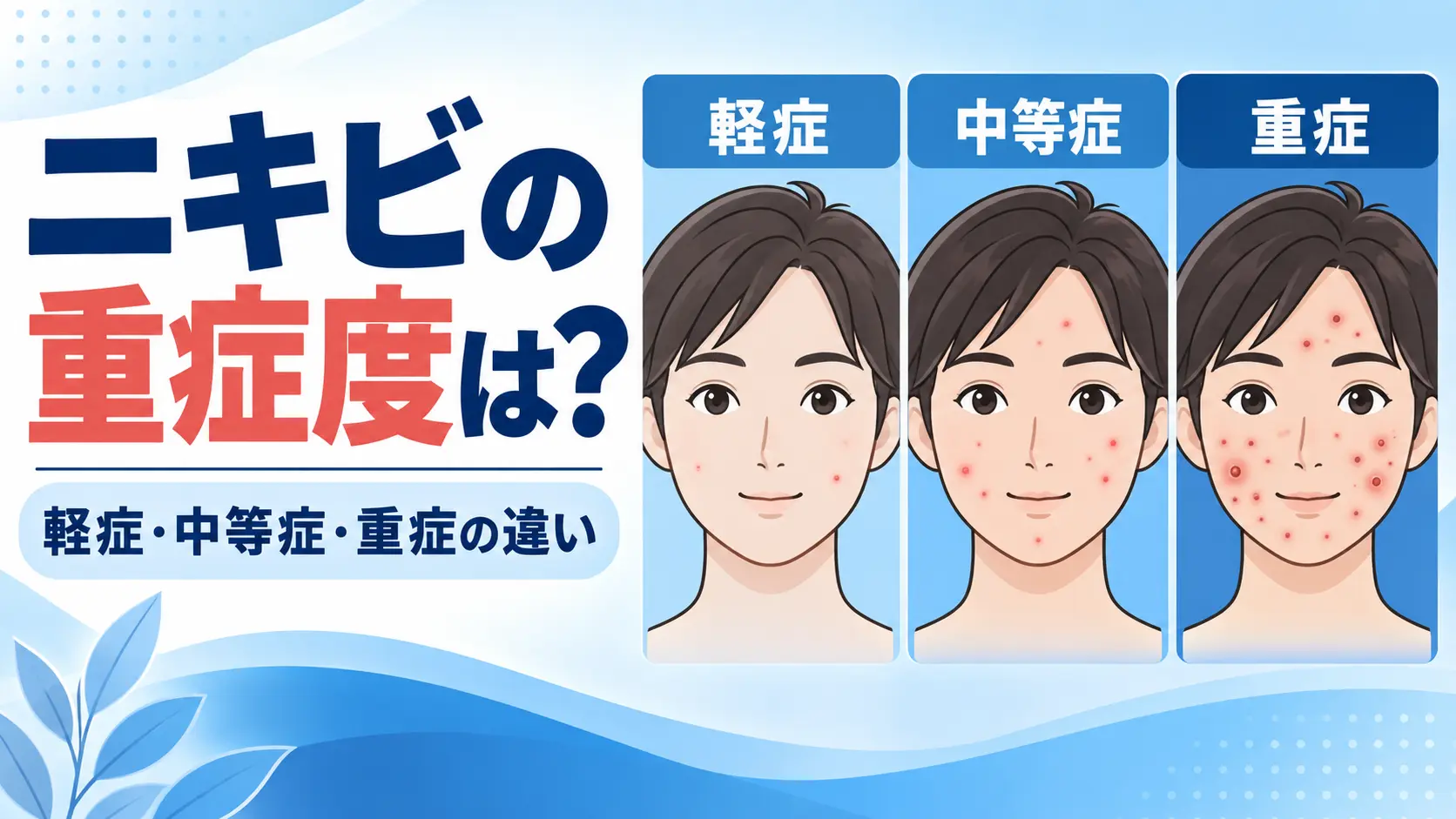 ニキビの重症度はどう決まる?軽症・中等症・重症の判定基準を解説のサムネイル画像
