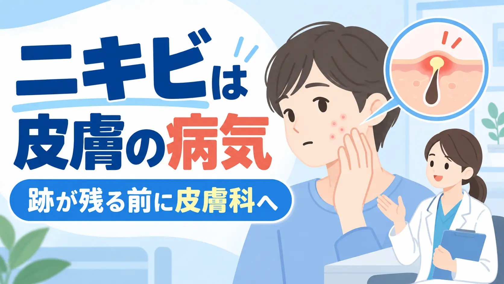 ニキビは皮膚の病気です|早めに治療したい理由とニキビ跡との関係のサムネイル画像